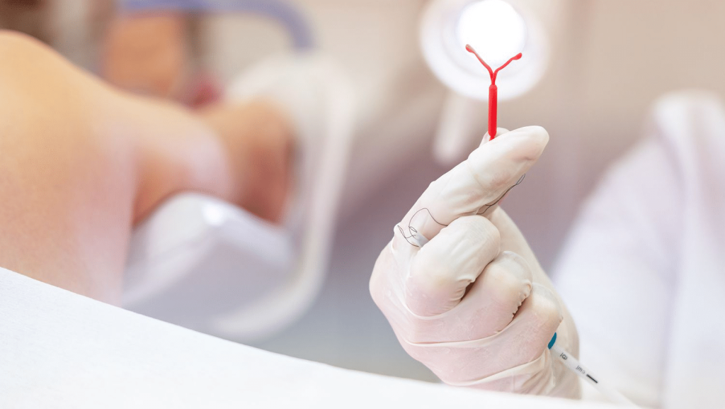 IUD insertion pain, how painful is IUD insertion