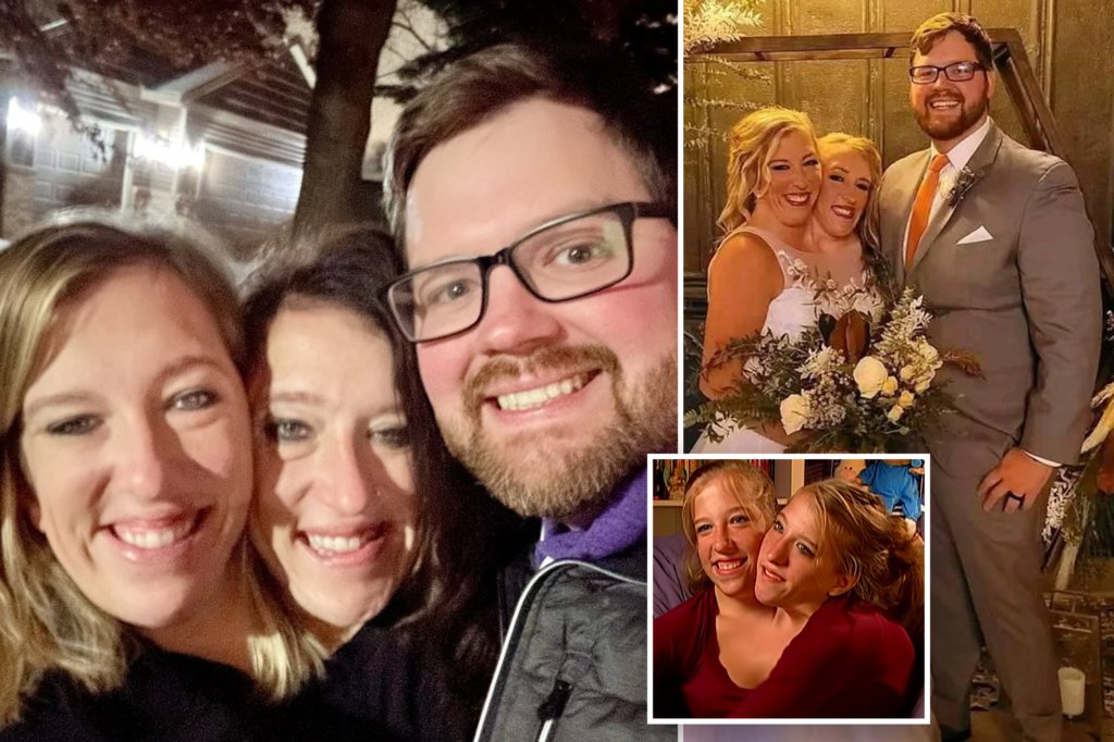 Conjoined twins Abby Hensel and Brittany Hensel are all smiles