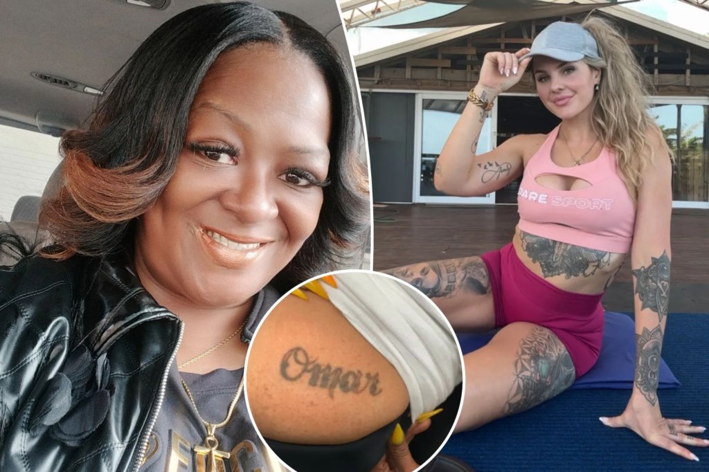 Women open tattoos after failure to remove tattoos