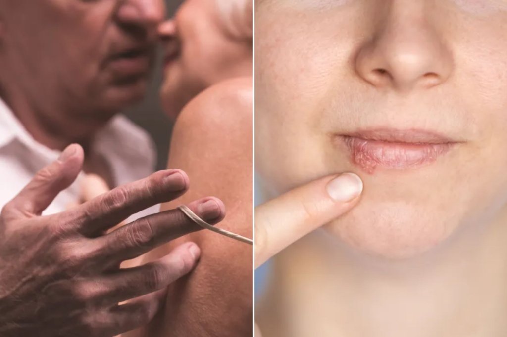 STIs that can increase the risk of dementia - an upward