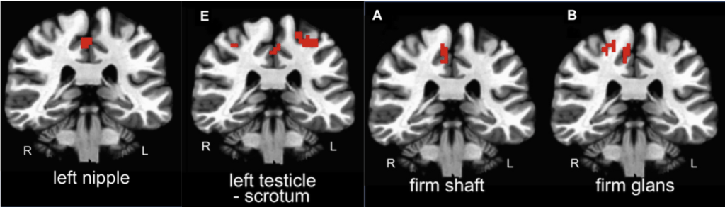 fMRI brain images